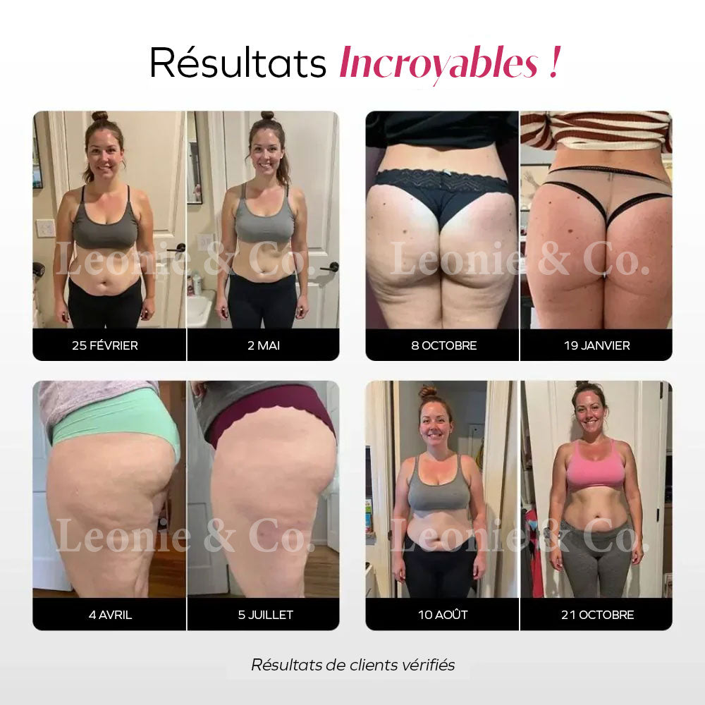 Legging 3D Anti-Cellulite - Cécile